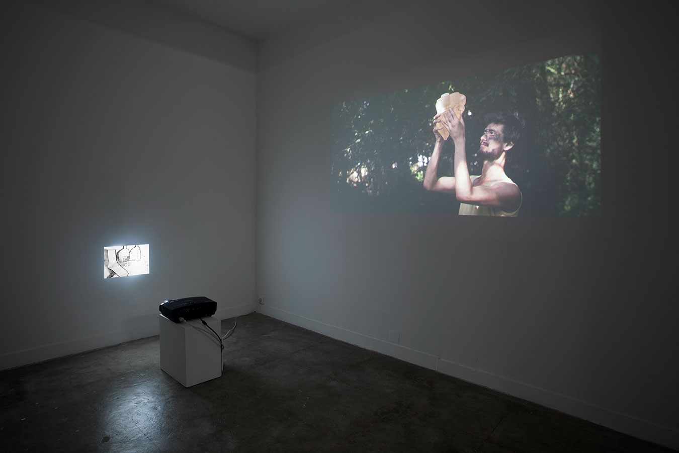 What’s the first thing you’re going to do when you get your new arms put on?