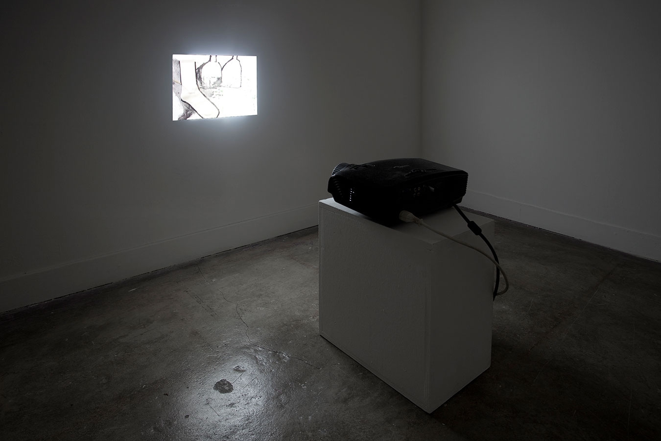 What’s the first thing you’re going to do when you get your new arms put on? - Galerie CrèveCoeur